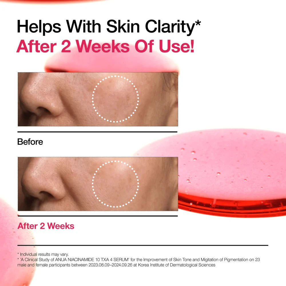 Niacinamide 10% + TXA Serum