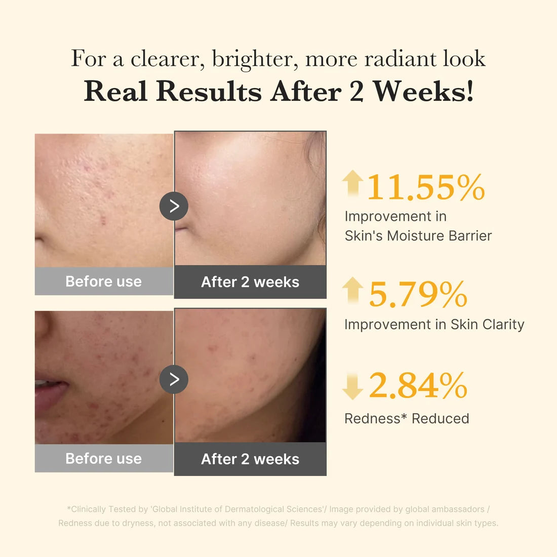 Medicube Kojic Acid Turmeric Niacinamide Serum for dark spots and uneven skin tone