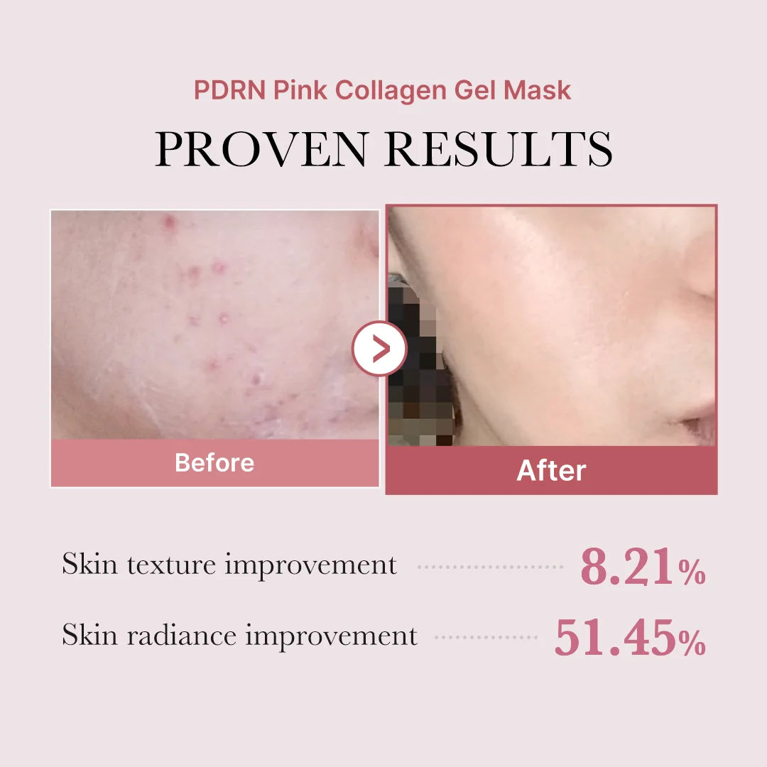 Medicube PDRN Pink Collagen Jelly Gel Mask results