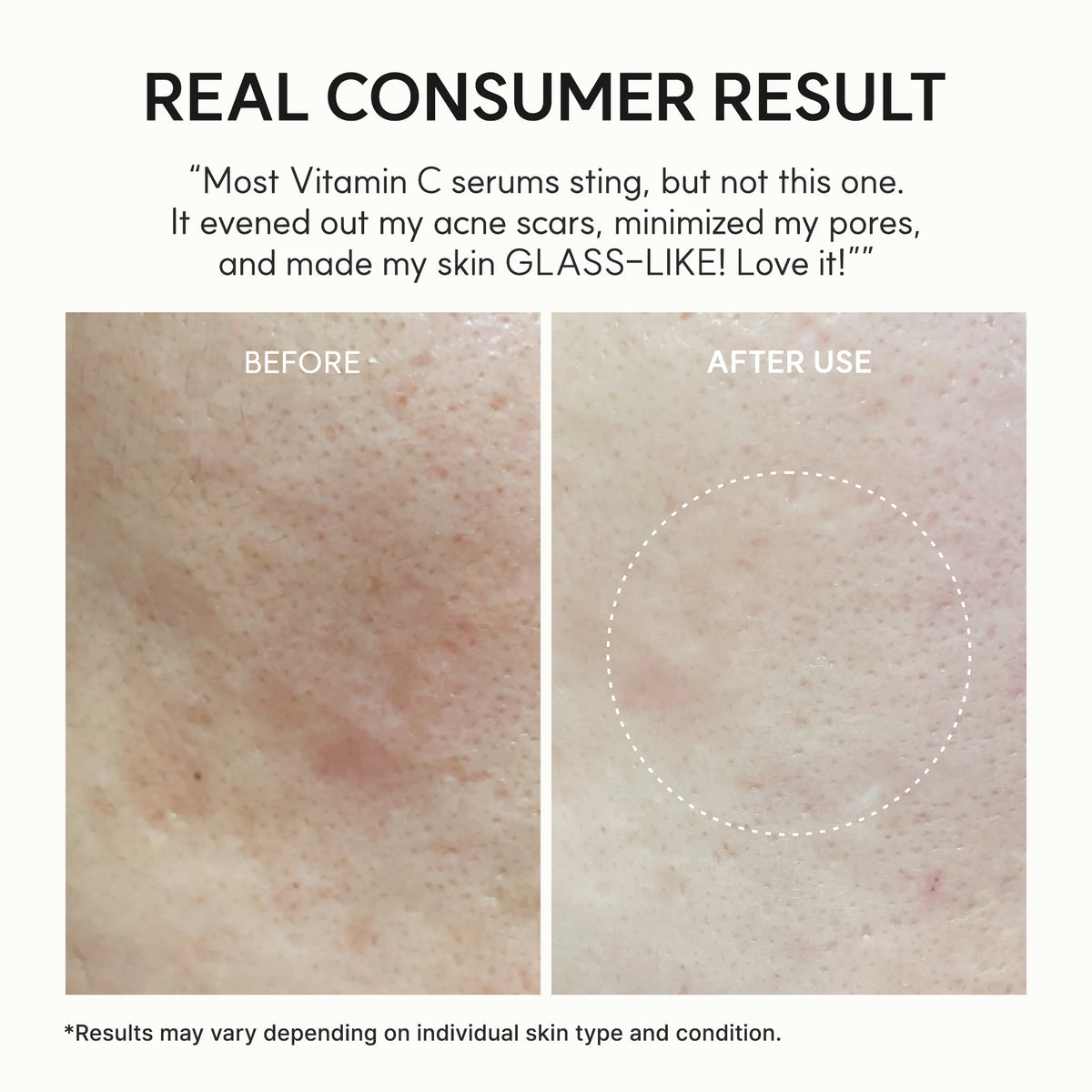 Vitamin C Booster Shot Pure Vitamin C Glutathione before and after results 